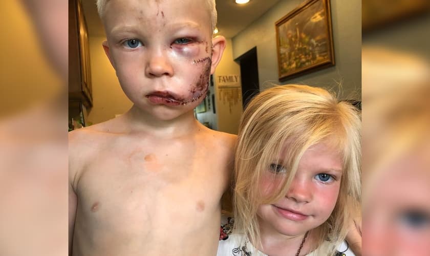 Bridger Walker (esquerda) defendeu sua irmã e evitou que ela fosse atacada por um cachorro. (Foto: Instagram)